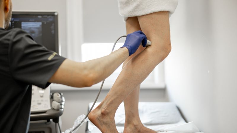 What is a Varicose Veins Doctor Called