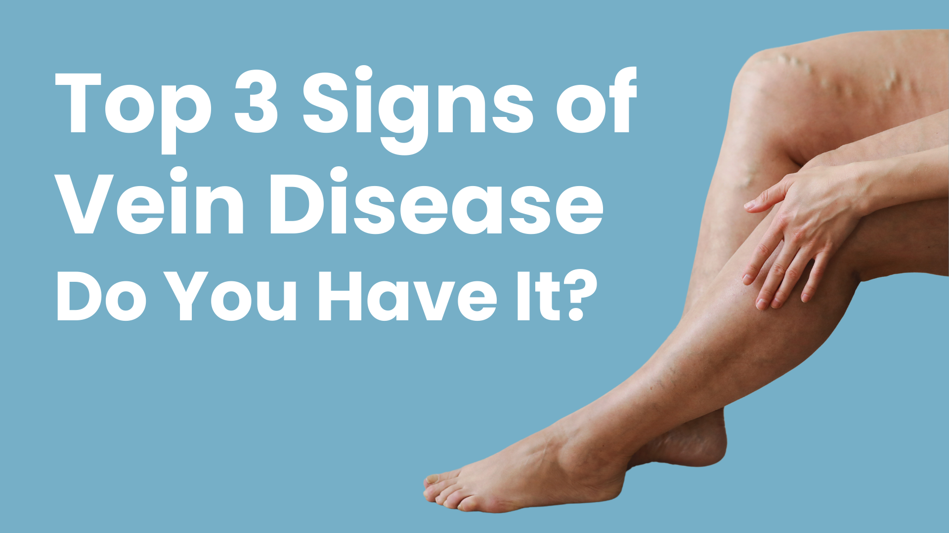 Top 3 Signs of Vein Disease (do you have it?)