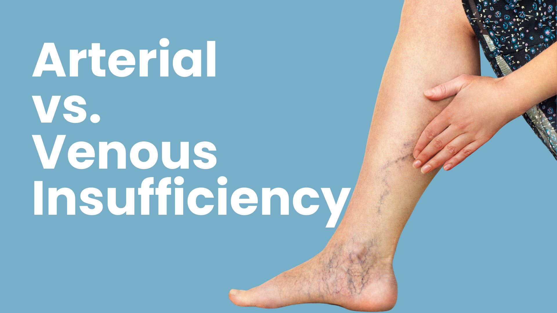 Arterial vs. Venous Insufficiency